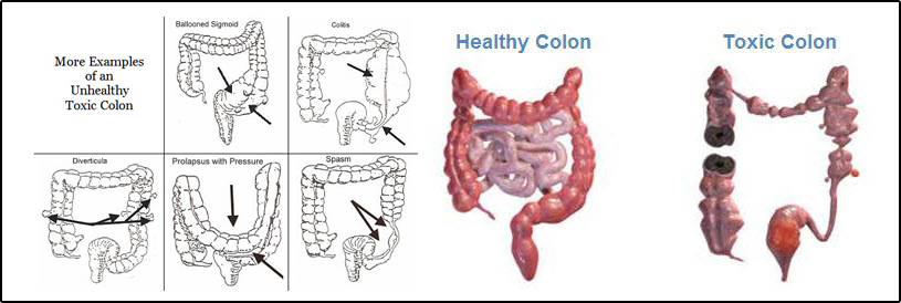 Colon-Charts